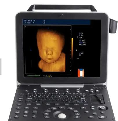 Professional China Ultrasound Imaging - DW-P6 color doppler baby 4d ultrasound scan machine – Dawei