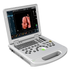 DW-L50(L5PRO) 3D/4D/5D Portable medical echo ultrasound scan machine - TecAfrica Solutions