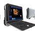 Professional China Ultrasound Imaging - DW-P6 color doppler baby 4d ultrasound scan machine – Dawei