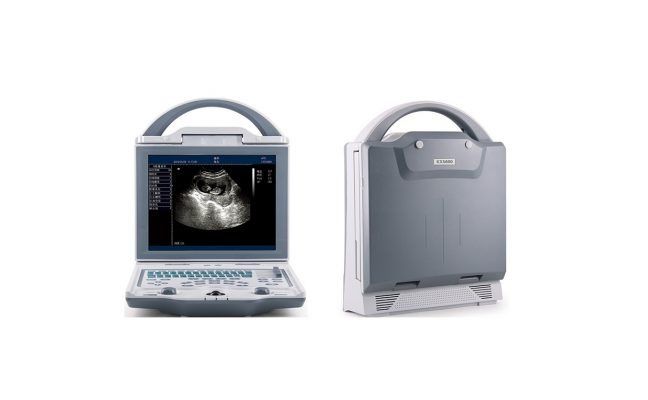 Rechargeable Human Ultrasound Scanner -KX5600