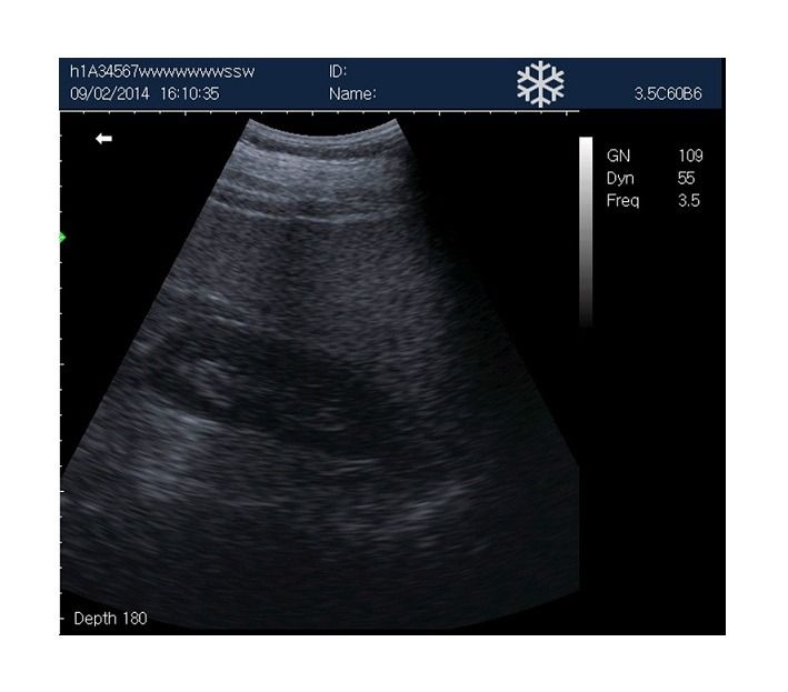 Rechargeable Human Ultrasound Scanner -KX5600