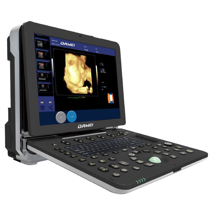 Professional China Ultrasound Imaging - DW-P6 color doppler baby 4d ultrasound scan machine – Dawei
