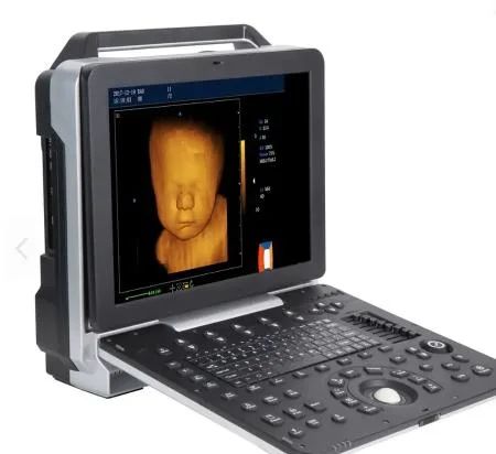 Professional China Ultrasound Imaging - DW-P6 color doppler baby 4d ultrasound scan machine – Dawei