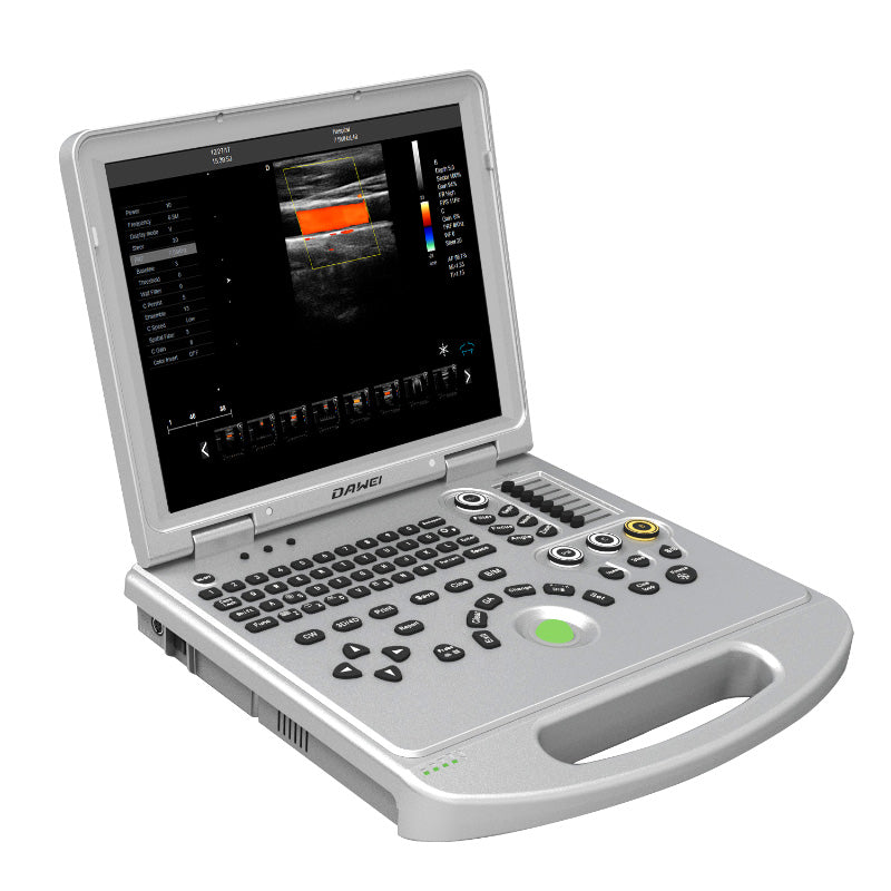 DW-L5（PF522) economical type laptop color doppler ultrasound baby scan - TecAfrica Solutions