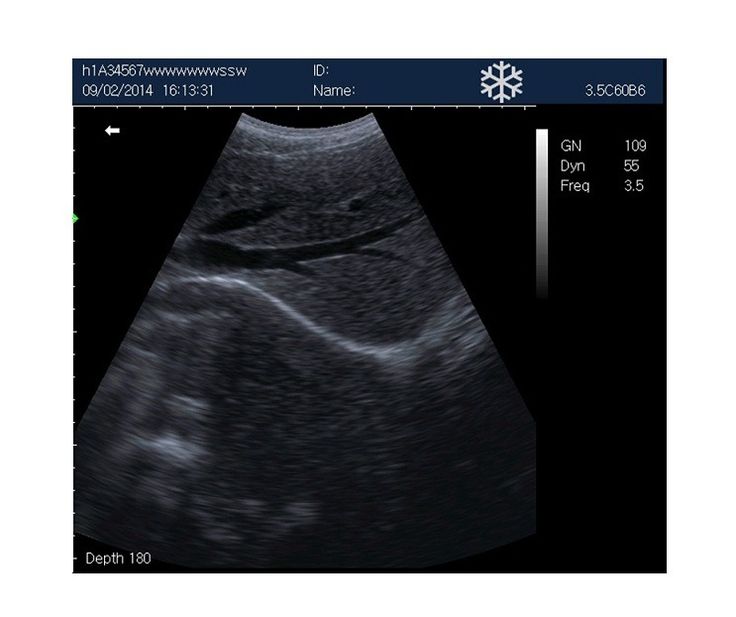 Rechargeable Human Ultrasound Scanner -KX5600