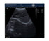 Rechargeable Human Ultrasound Scanner -KX5600