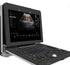 Professional China Ultrasound Imaging - DW-P6 color doppler baby 4d ultrasound scan machine – Dawei
