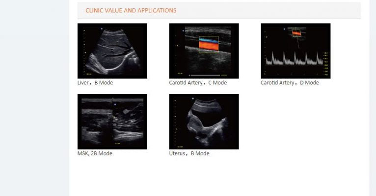 Cardiovascular Color Doppler ECO 5