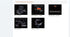 Cardiovascular Color Doppler ECO 5