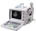 US9618 Portable Ultrasound Scanner with Convex Probe