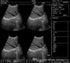 XF300 (LED) B ultrasound diagnose medical instrument